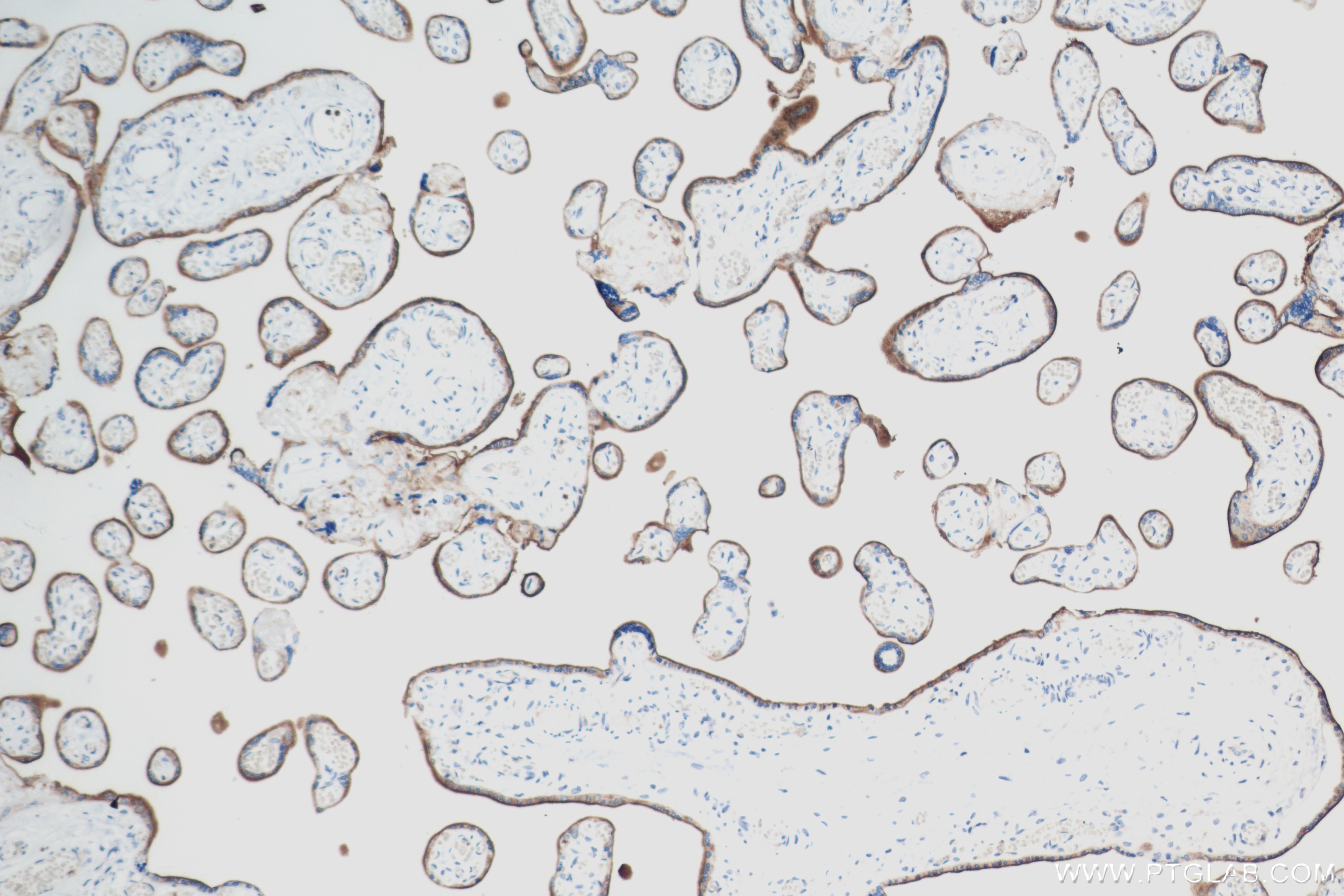 Immunohistochemistry (IHC) staining of human placenta tissue using VISTA Recombinant antibody (83919-4-RR)