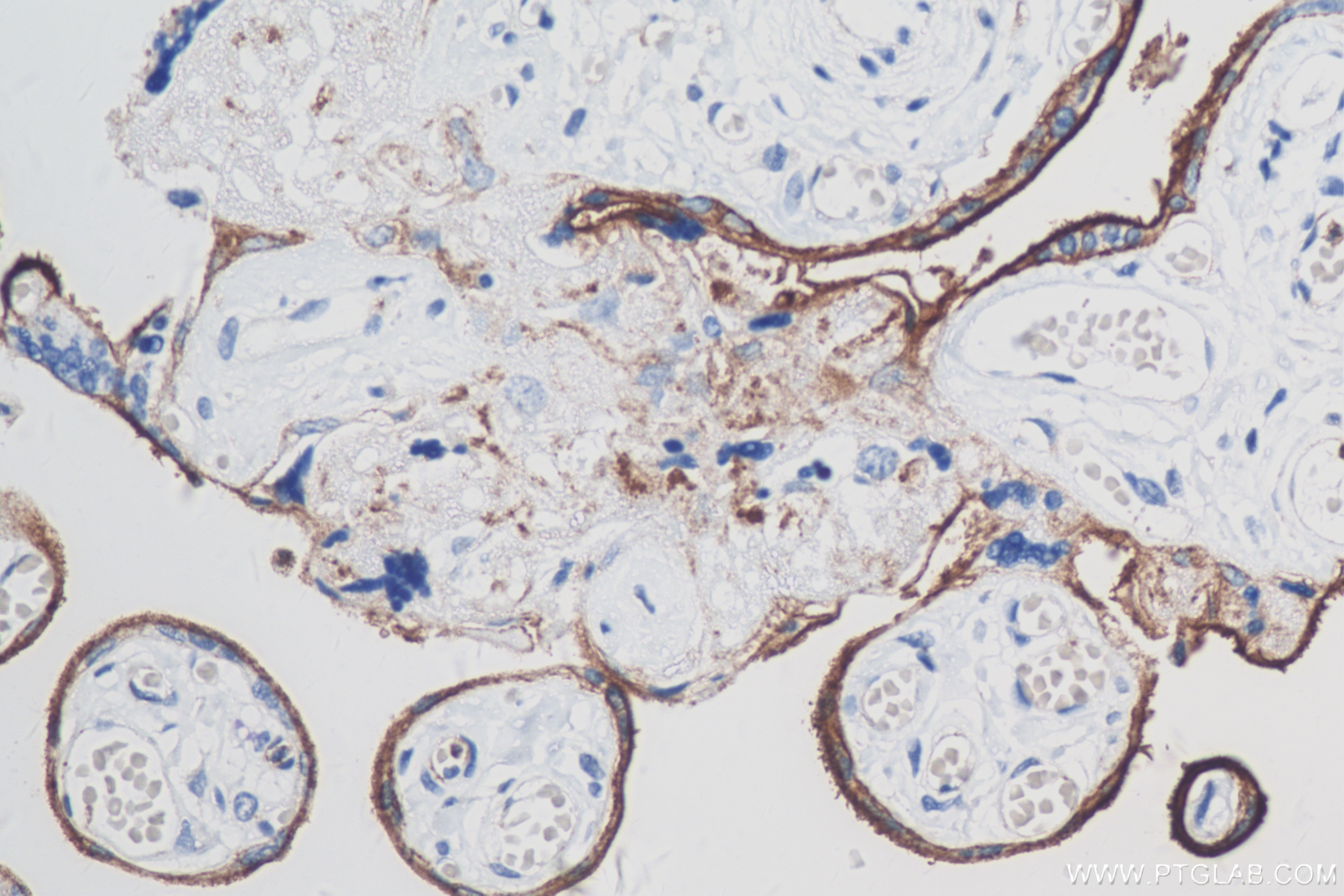 Immunohistochemistry (IHC) staining of human placenta tissue using VISTA Recombinant antibody (83919-4-RR)