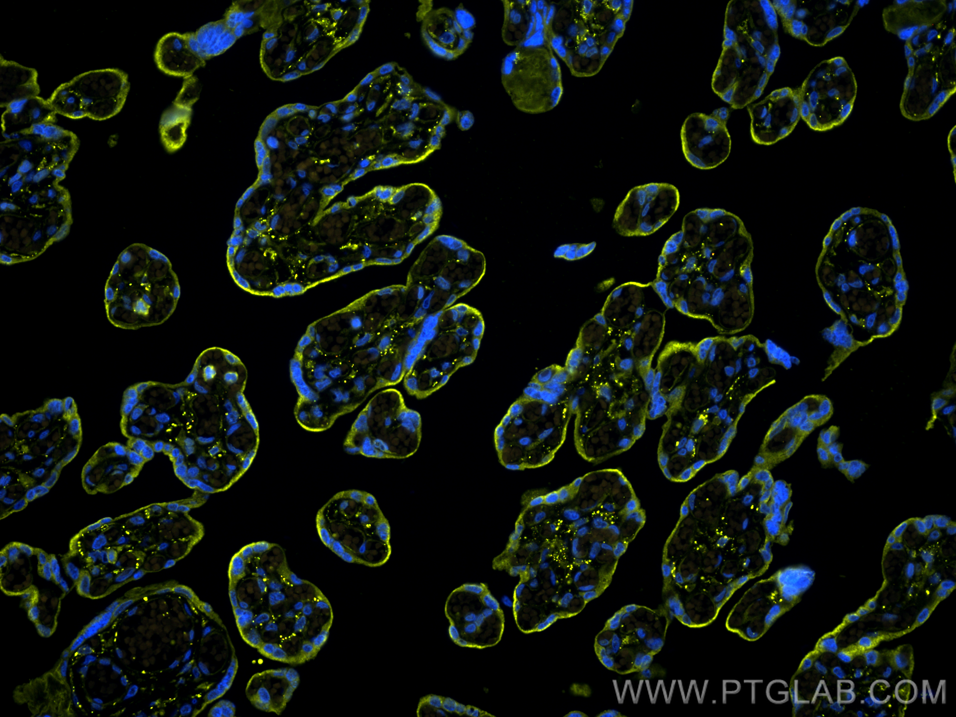 Immunofluorescence (IF) / fluorescent staining of human placenta tissue using CoraLite®532-conjugated VISTA Polyclonal antibody (CL532-24849)