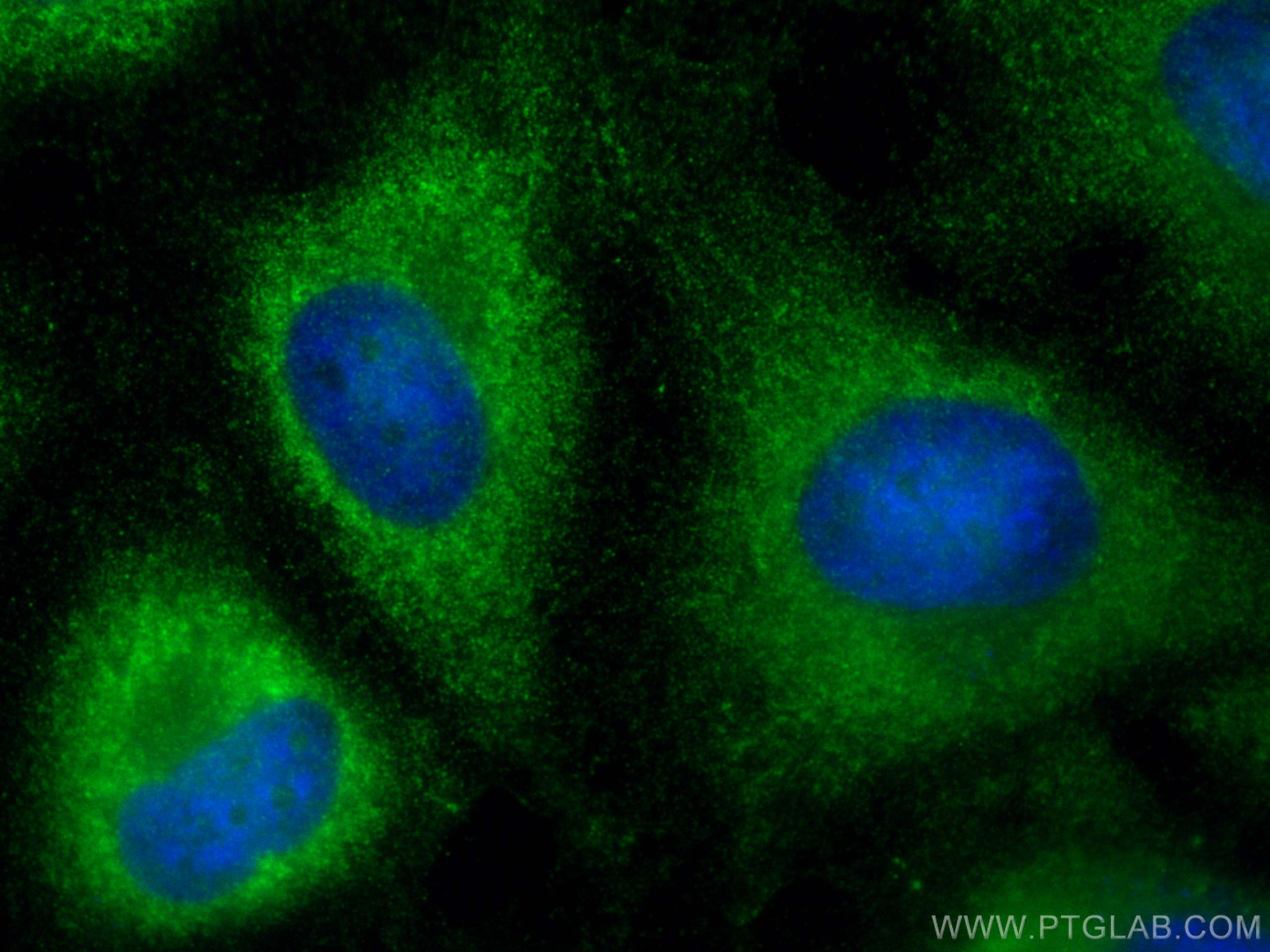 Immunofluorescence (IF) / fluorescent staining of HeLa cells using VLDLR Polyclonal antibody (19493-1-AP)