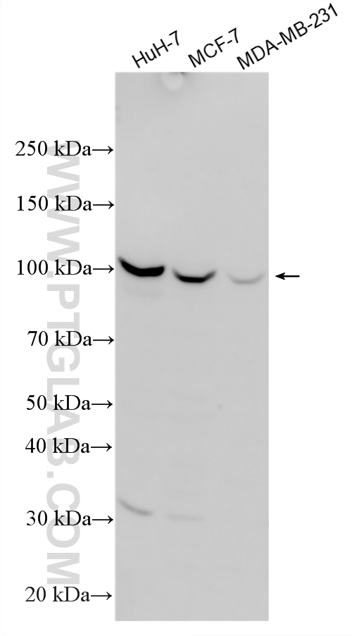 Western Blot (WB) analysis of various lysates using VLDLR Polyclonal antibody (19493-1-AP)