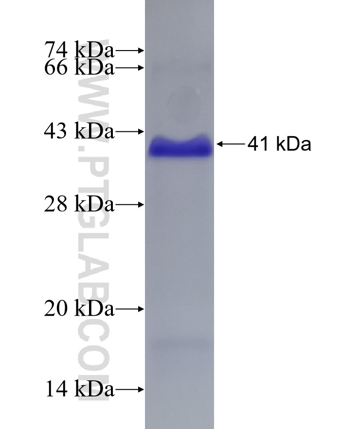 VLDLR fusion protein Ag28835 SDS-PAGE