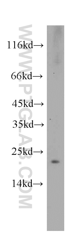 Western Blot (WB) analysis of HeLa cells using VMO1 Polyclonal antibody (21577-1-AP)