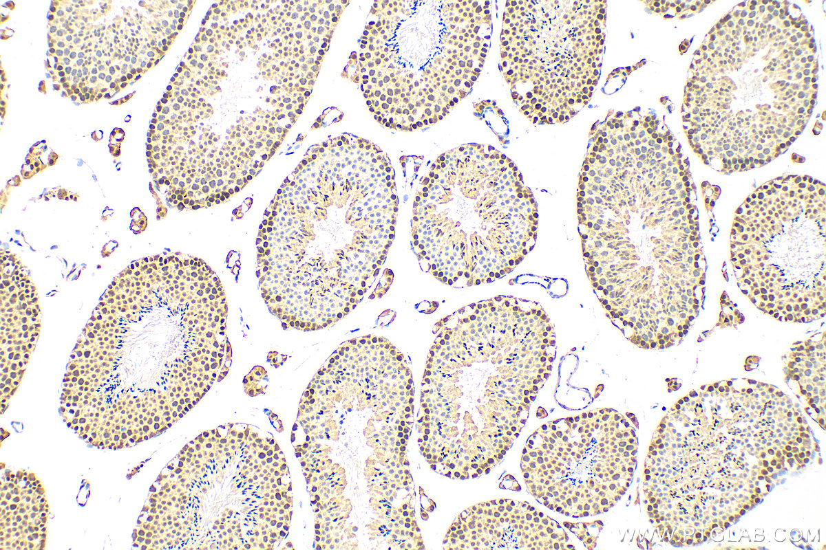 Immunohistochemistry (IHC) staining of mouse testis tissue using VPRBP Polyclonal antibody (11612-1-AP)