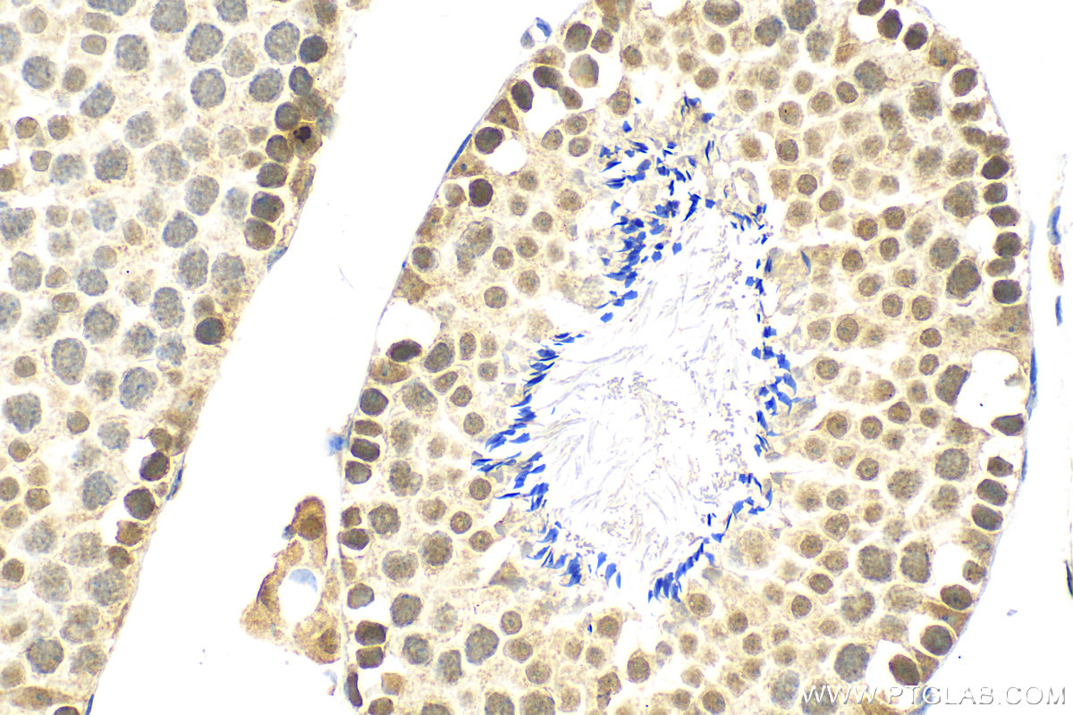 Immunohistochemistry (IHC) staining of mouse testis tissue using VPRBP Polyclonal antibody (11612-1-AP)