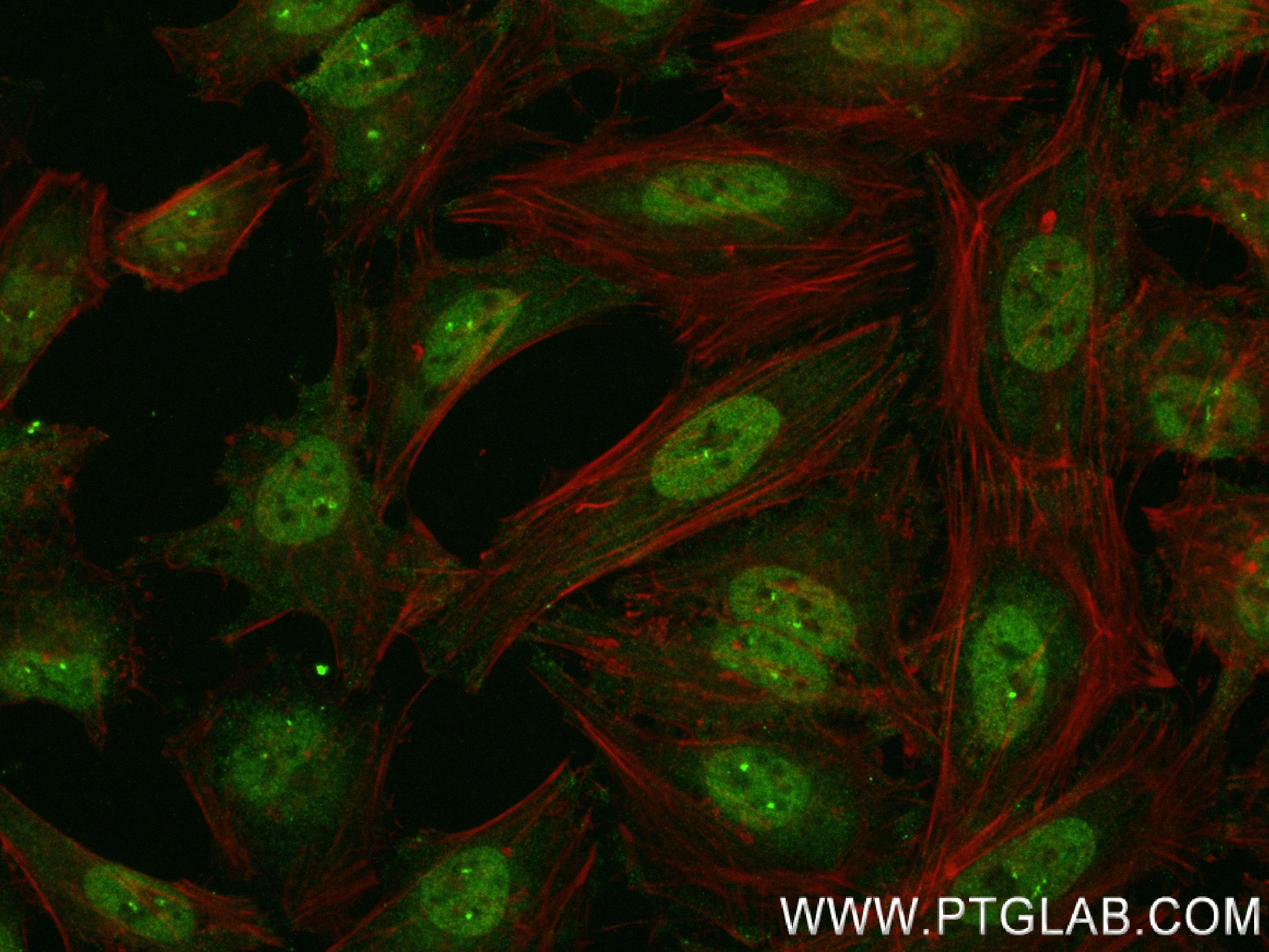 Immunofluorescence (IF) / fluorescent staining of HeLa cells using VPRBP Recombinant antibody (83901-3-RR)