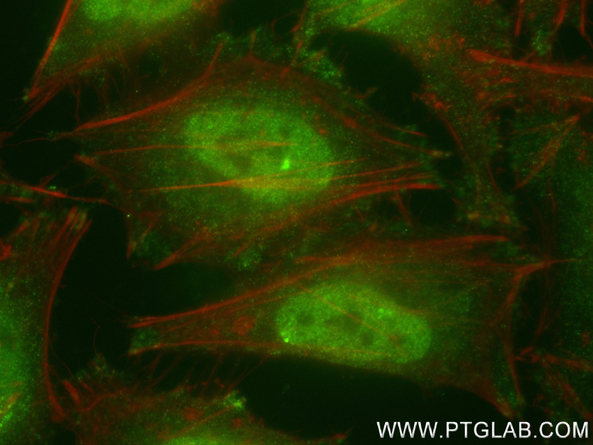 Immunofluorescence (IF) / fluorescent staining of HeLa cells using VPRBP Recombinant antibody (83901-3-RR)