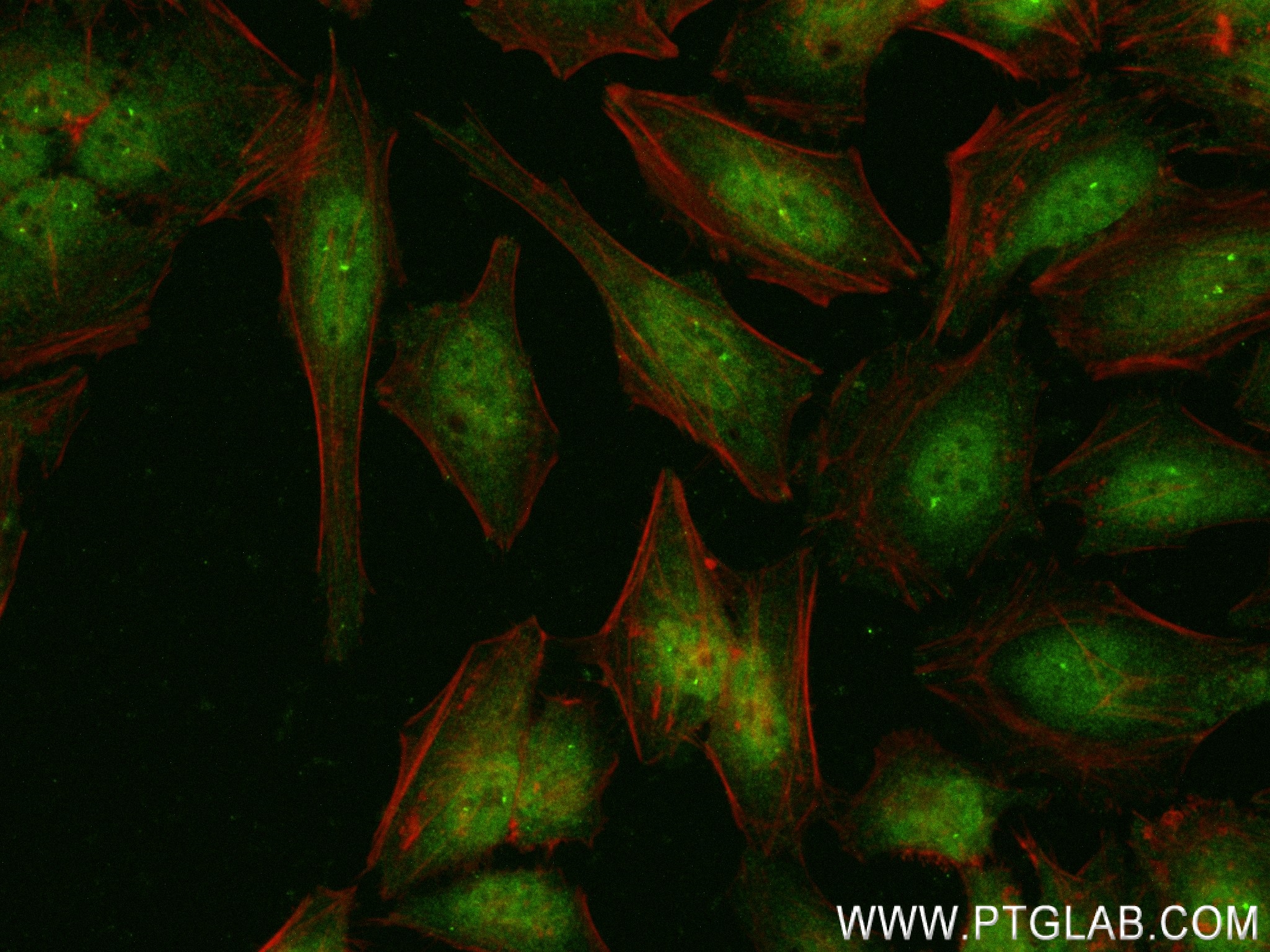 Immunofluorescence (IF) / fluorescent staining of HeLa cells using VPRBP Recombinant antibody (83901-5-RR)