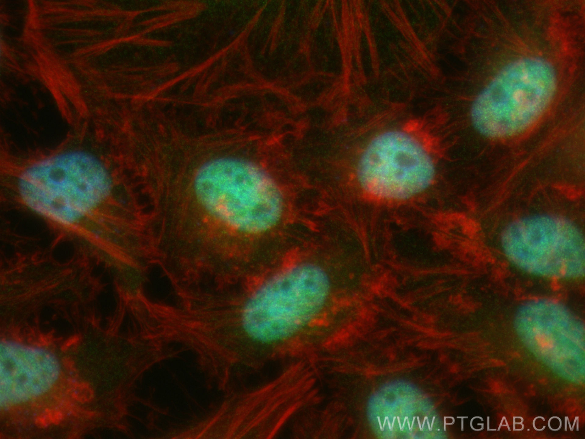 Immunofluorescence (IF) / fluorescent staining of HeLa cells using VPRBP Recombinant antibody (83901-5-RR)