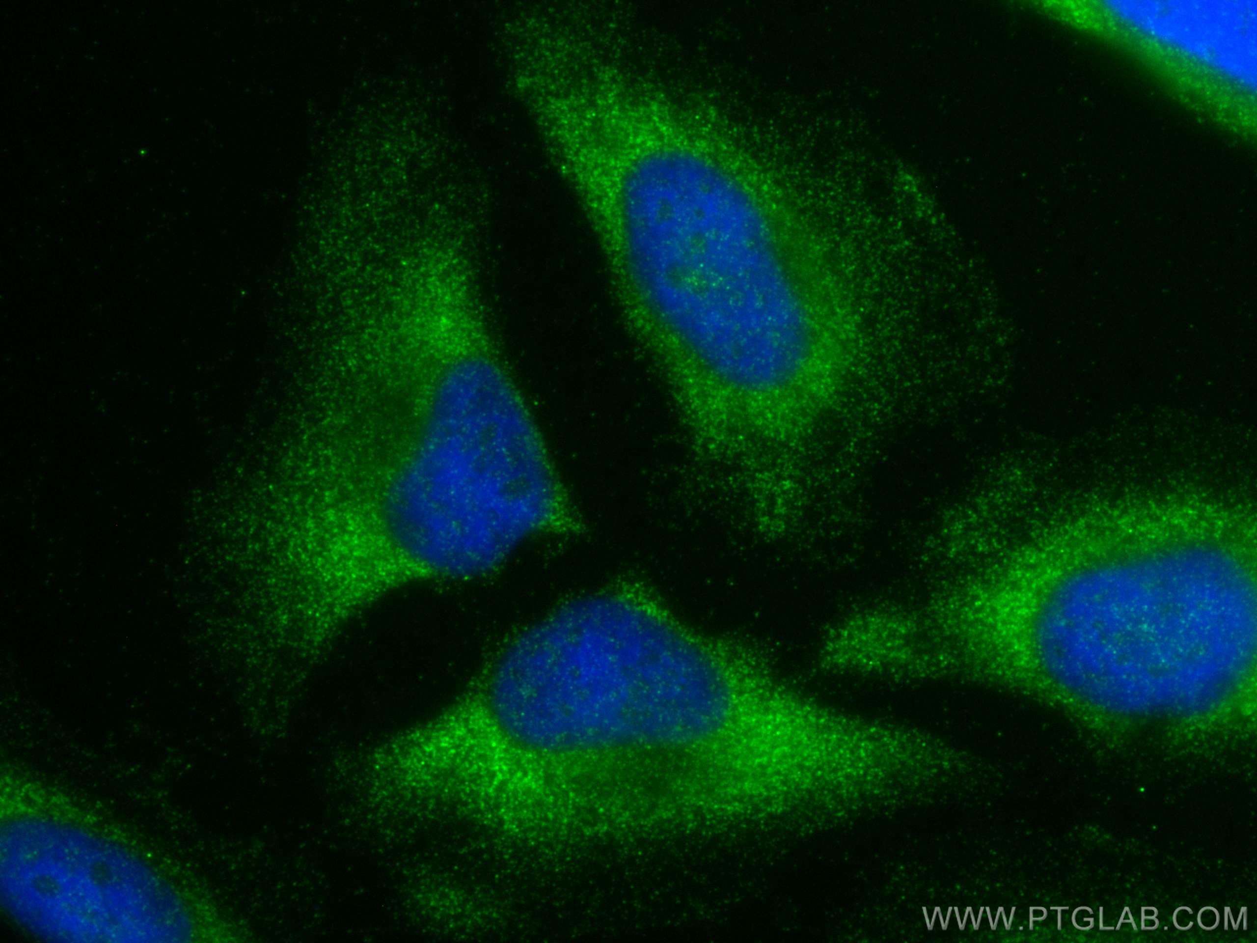 Immunofluorescence (IF) / fluorescent staining of HeLa cells using VPS13B Polyclonal antibody (24505-1-AP)