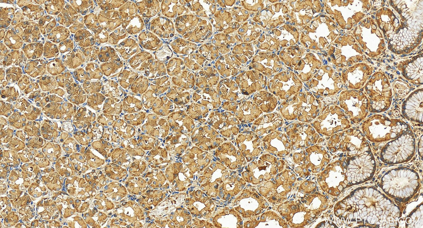 Immunohistochemistry (IHC) staining of human stomach tissue using VPS13C Polyclonal antibody (28676-1-AP)