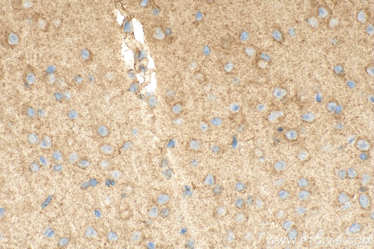 Immunohistochemistry (IHC) staining of mouse brain tissue using VPS18 Polyclonal antibody (10901-1-AP)