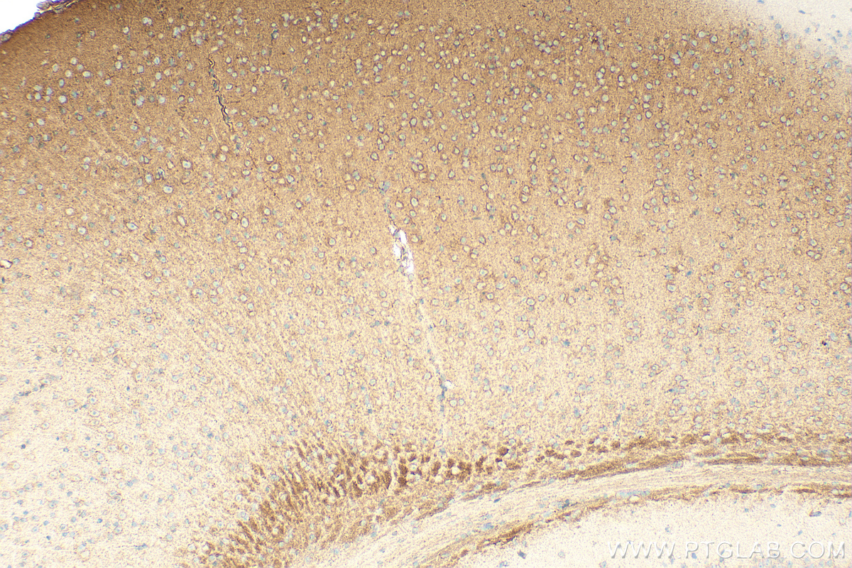 Immunohistochemistry (IHC) staining of mouse brain tissue using VPS18 Polyclonal antibody (10901-1-AP)