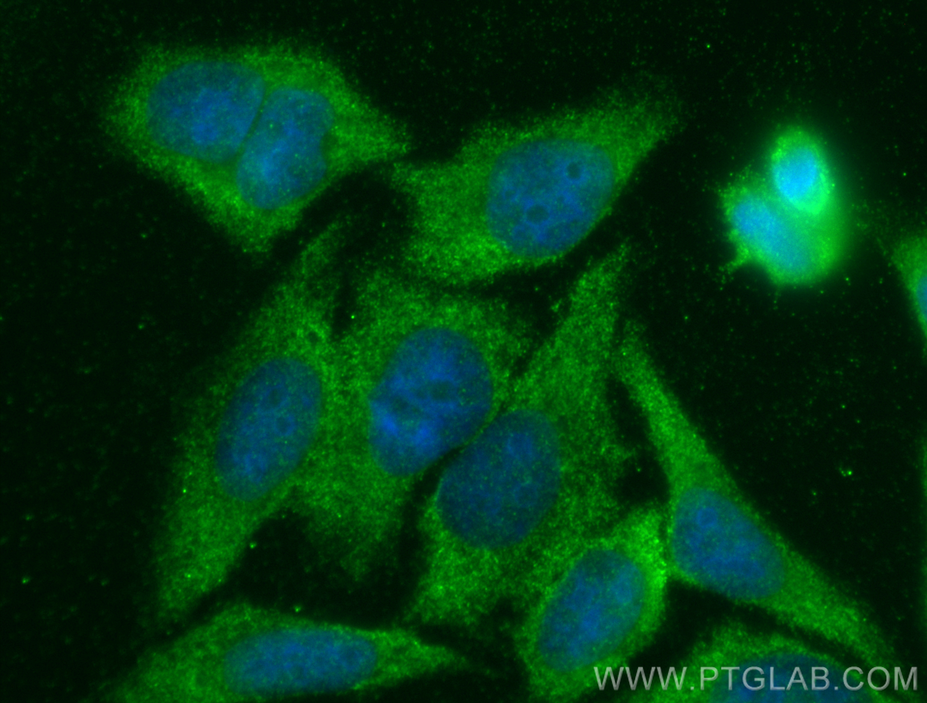 Immunofluorescence (IF) / fluorescent staining of HepG2 cells using VPS24 Polyclonal antibody (15472-1-AP)