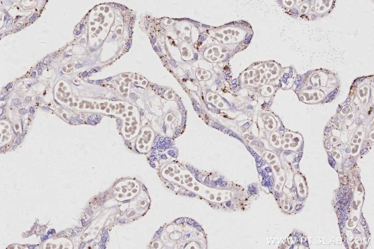 Immunohistochemistry (IHC) staining of human placenta tissue using VPS24 Polyclonal antibody (15472-1-AP)