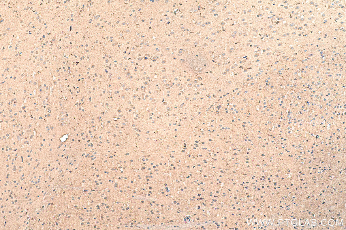 Immunohistochemistry (IHC) staining of mouse brain tissue using VPS25 Polyclonal antibody (15669-1-AP)