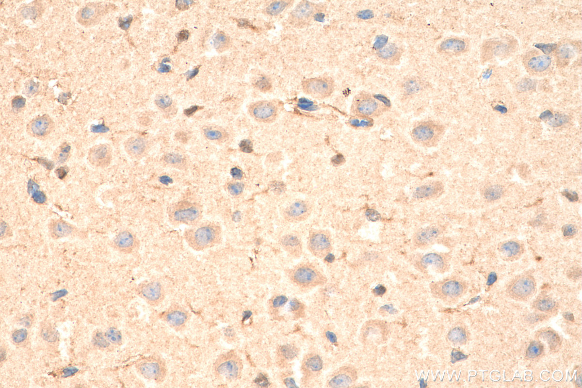 Immunohistochemistry (IHC) staining of mouse brain tissue using VPS25 Polyclonal antibody (15669-1-AP)