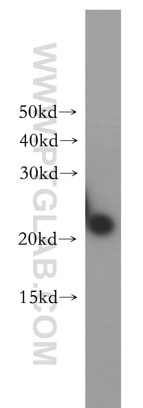 Western Blot (WB) analysis of human brain tissue using VPS25 Polyclonal antibody (15669-1-AP)