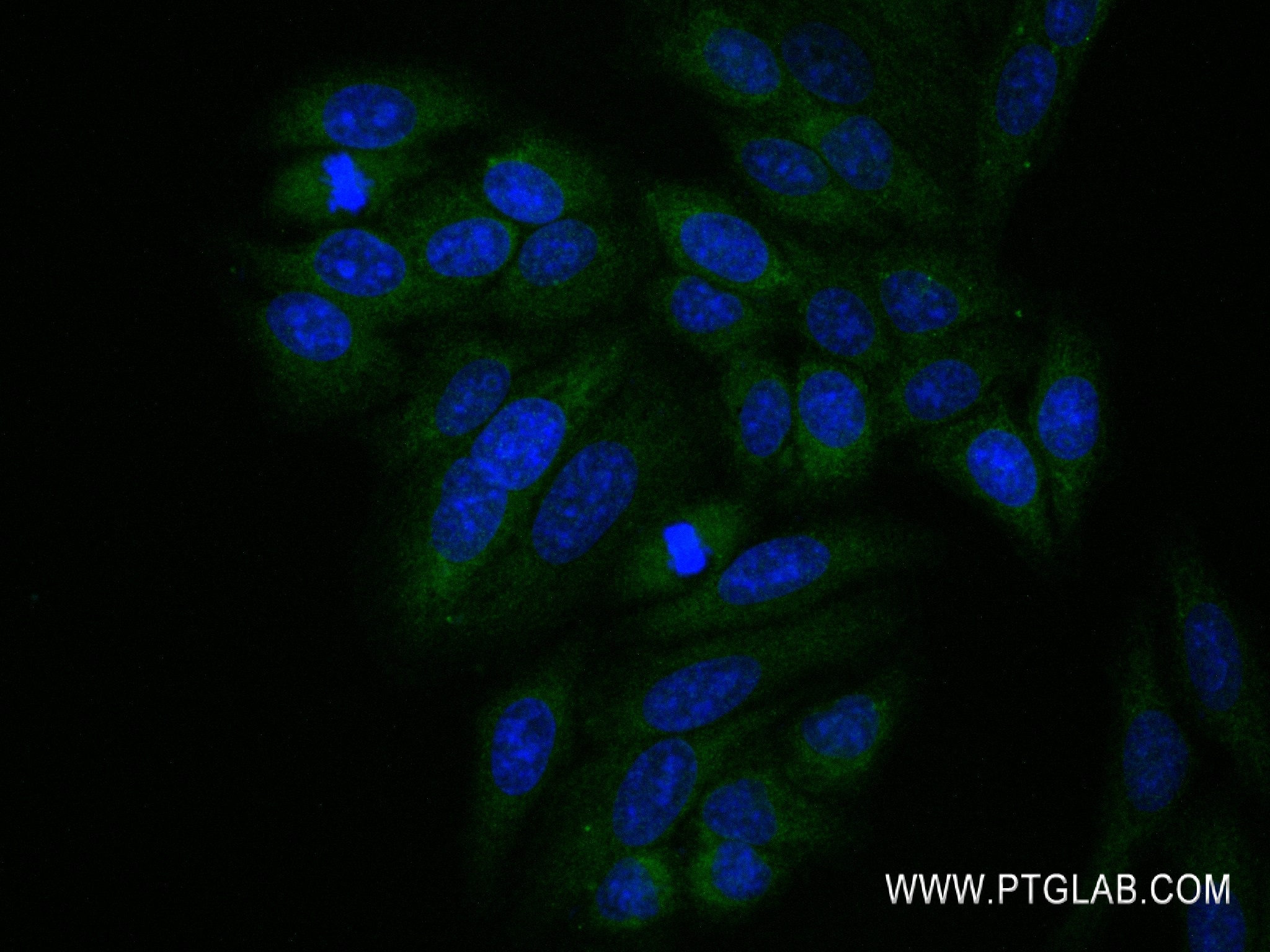 Immunofluorescence (IF) / fluorescent staining of HepG2 cells using VPS28 Recombinant antibody (84472-4-RR)