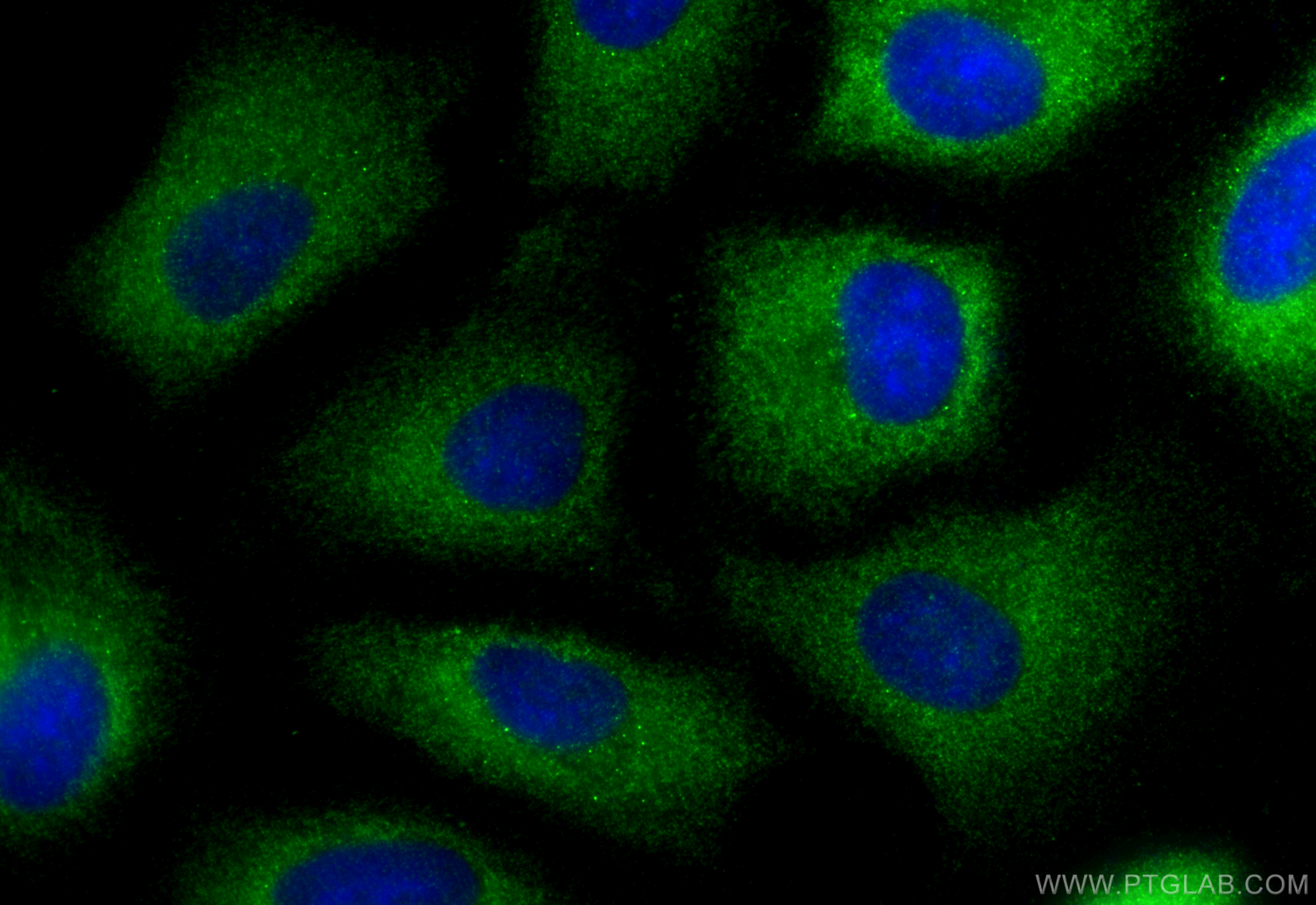 Immunofluorescence (IF) / fluorescent staining of A549 cells using VPS28 Recombinant antibody (84472-4-RR)