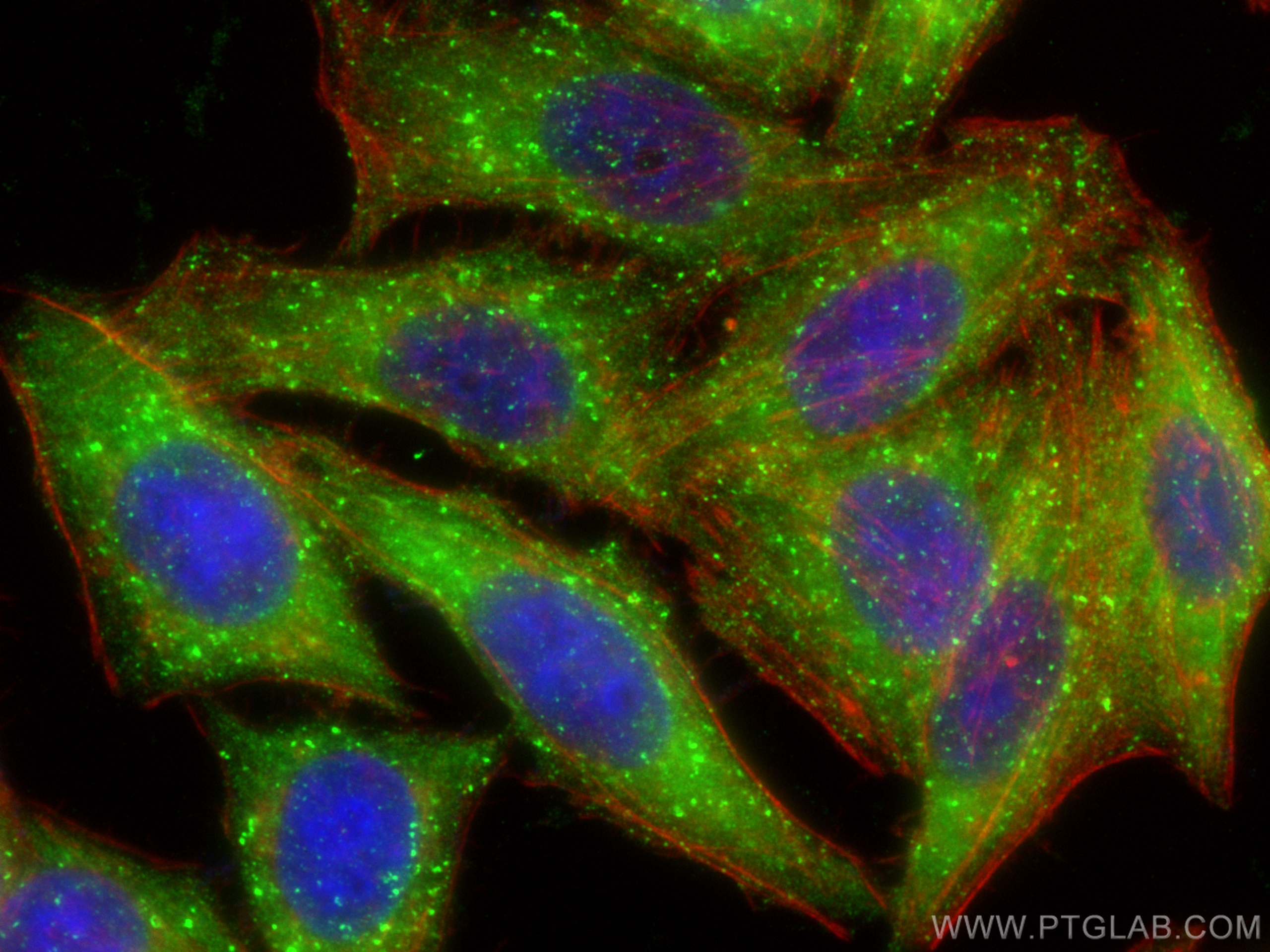 Immunofluorescence (IF) / fluorescent staining of HepG2 cells using VPS35 Polyclonal antibody (10236-1-AP)