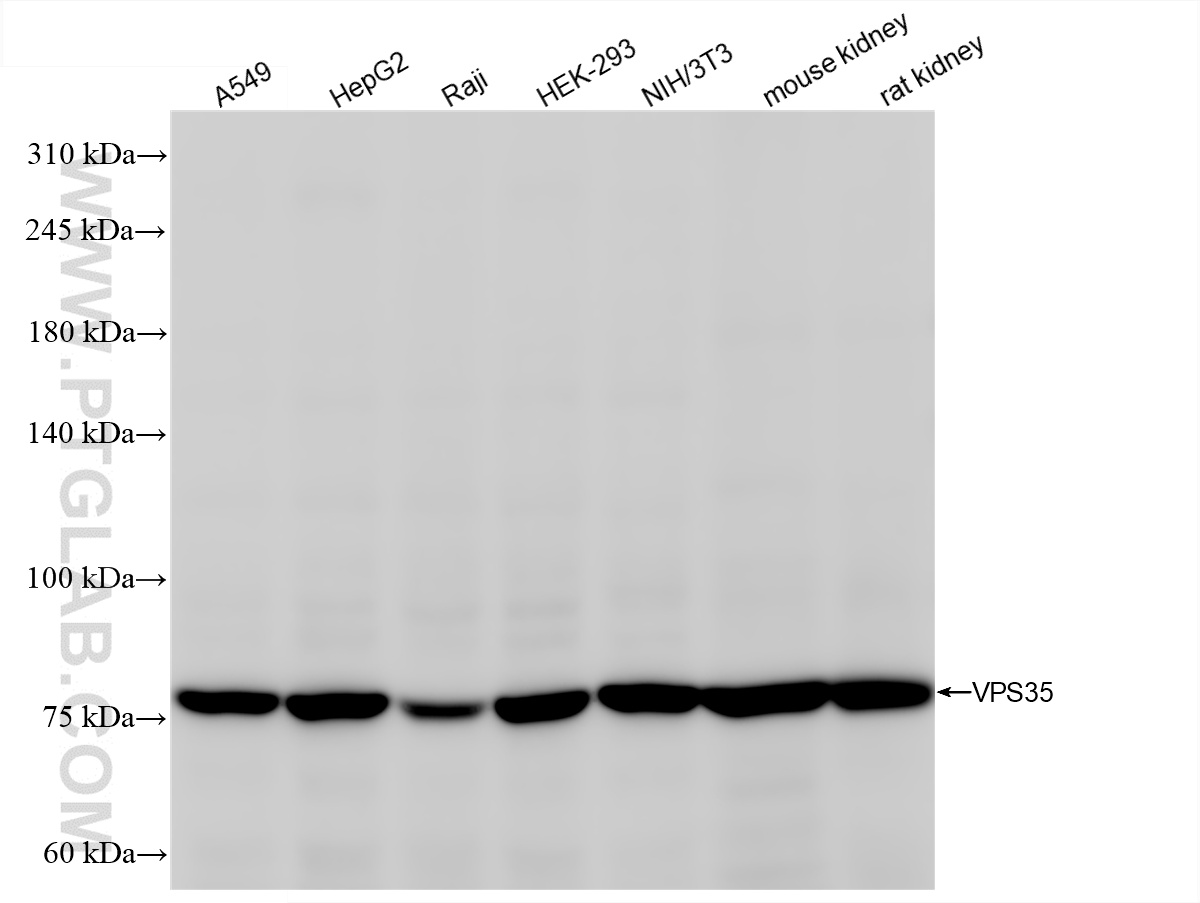 Western Blot (WB) analysis of various lysates using VPS35 Recombinant antibody (83328-2-RR)