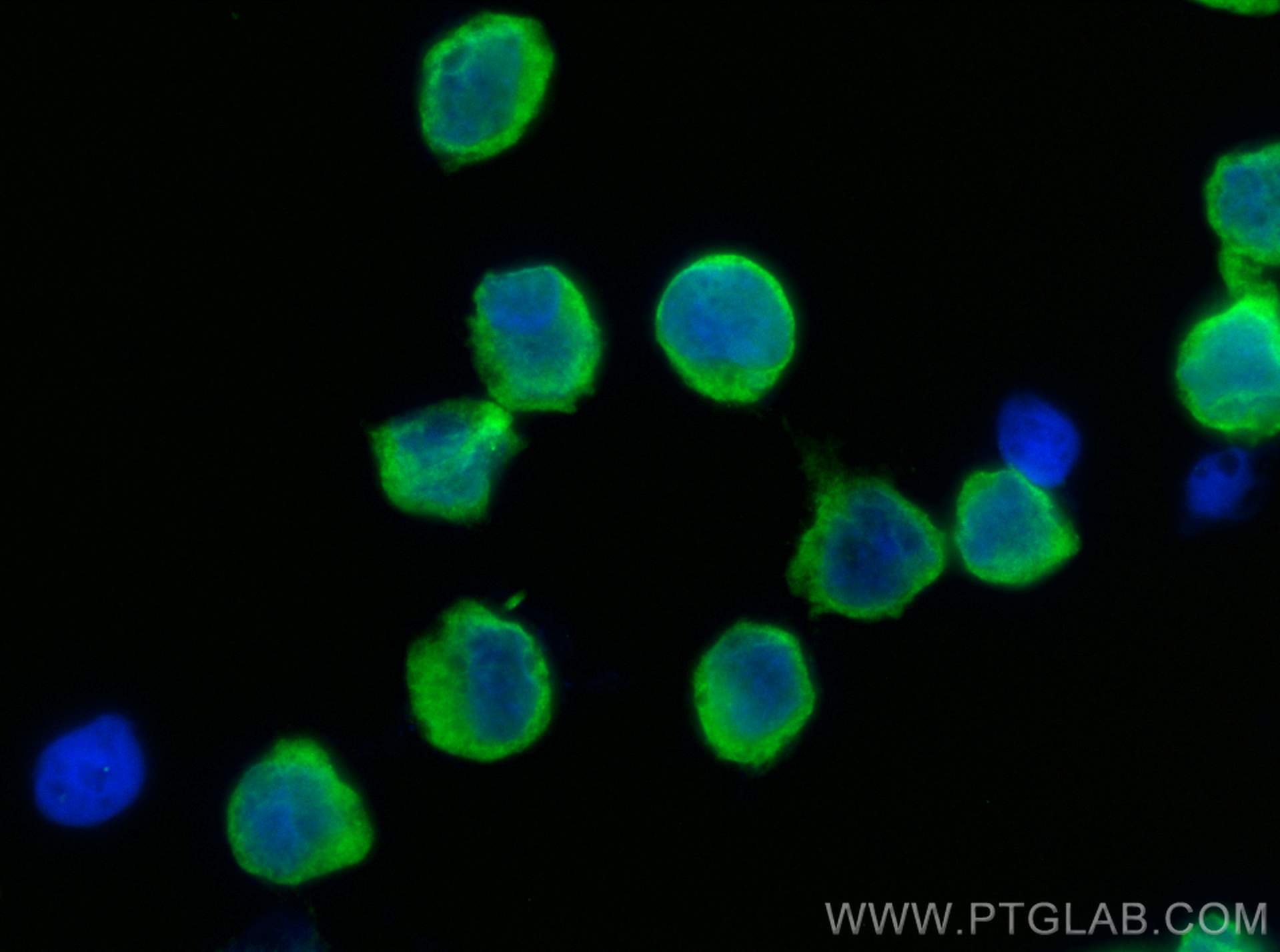 Immunofluorescence (IF) / fluorescent staining of Raji cells using VPS37C Polyclonal antibody (27128-1-AP)