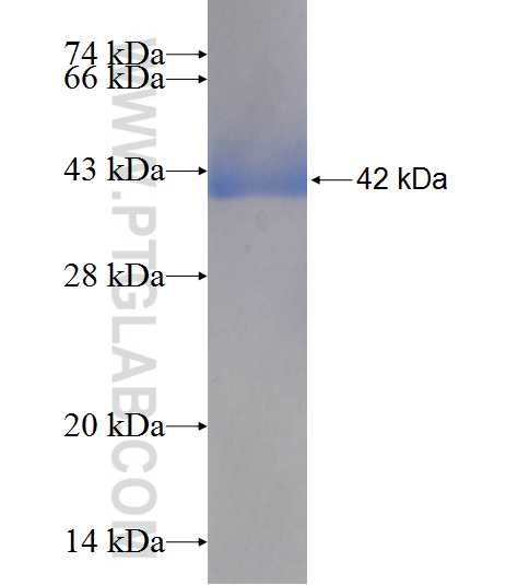 VPS39 fusion protein Ag9158 SDS-PAGE