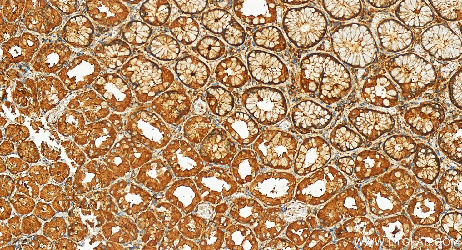 Immunohistochemistry (IHC) staining of human stomach tissue using VPS53 Polyclonal antibody (12824-1-AP)