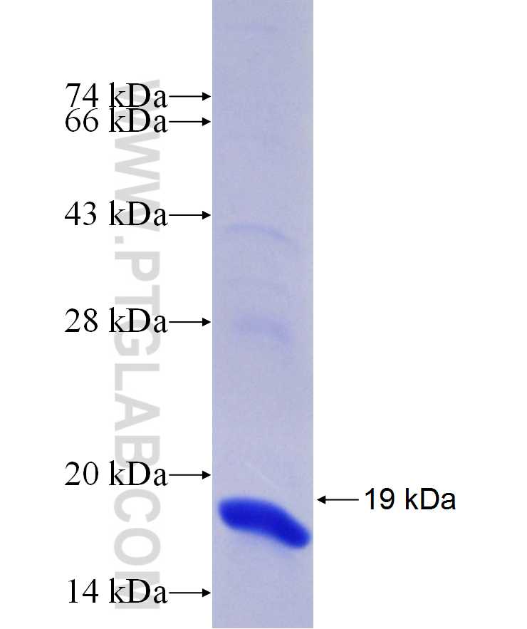 VPS53 fusion protein Ag29875 SDS-PAGE