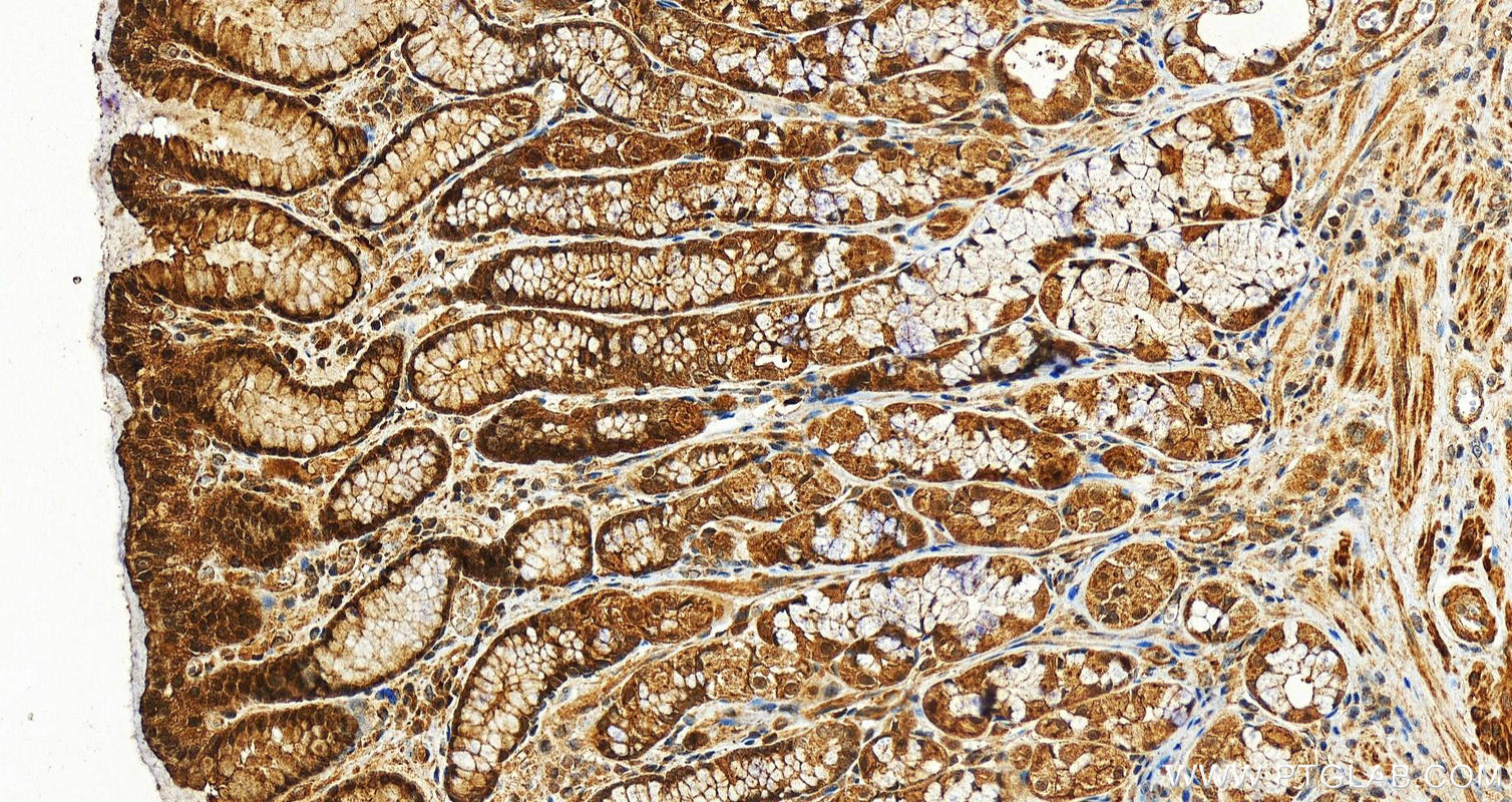 Immunohistochemistry (IHC) staining of human stomach tissue using VRK2 Polyclonal antibody (12946-1-AP)