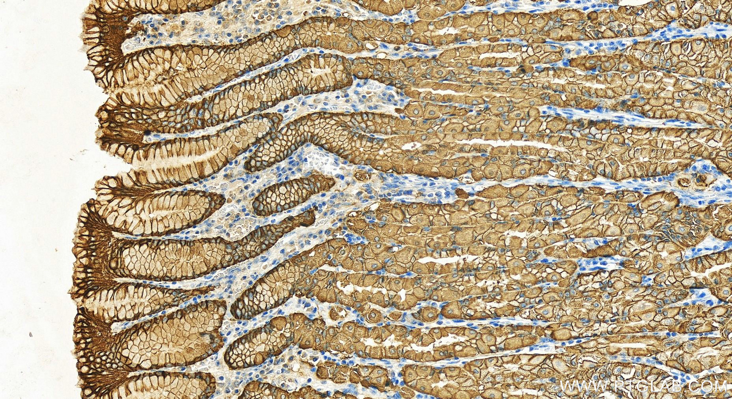 Immunohistochemistry (IHC) staining of human stomach tissue using VSIG1 Polyclonal antibody (14145-1-AP)