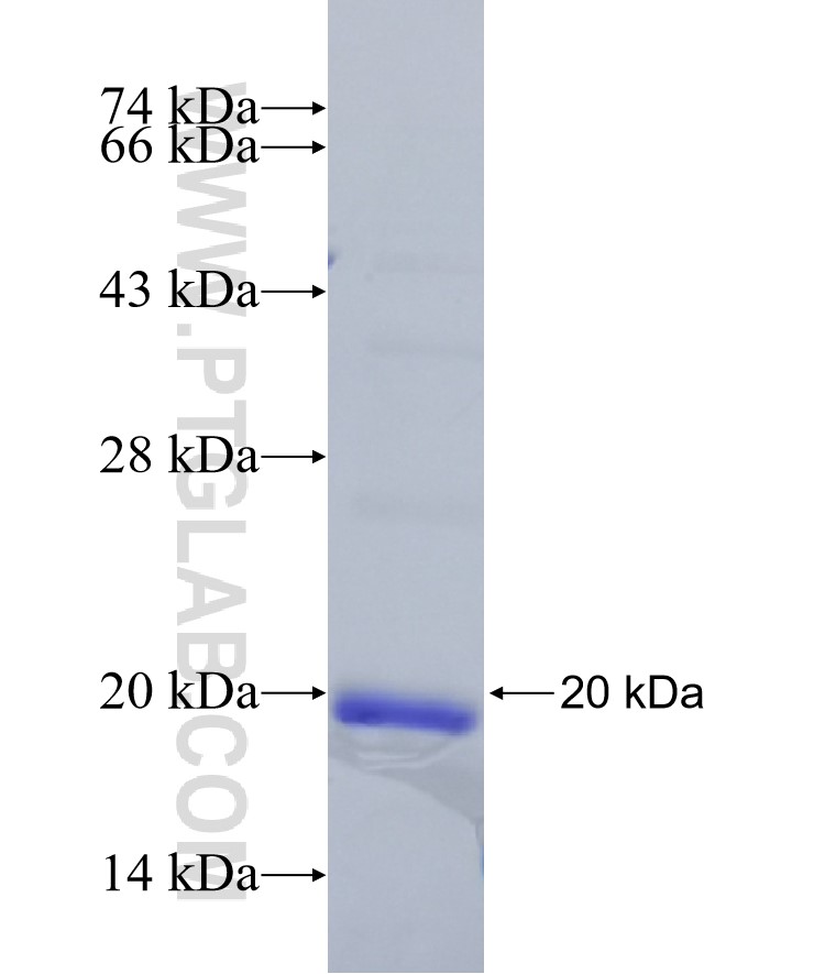 VSTM2L fusion protein Ag22362 SDS-PAGE