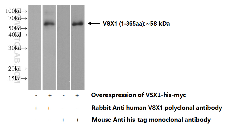 VSX1