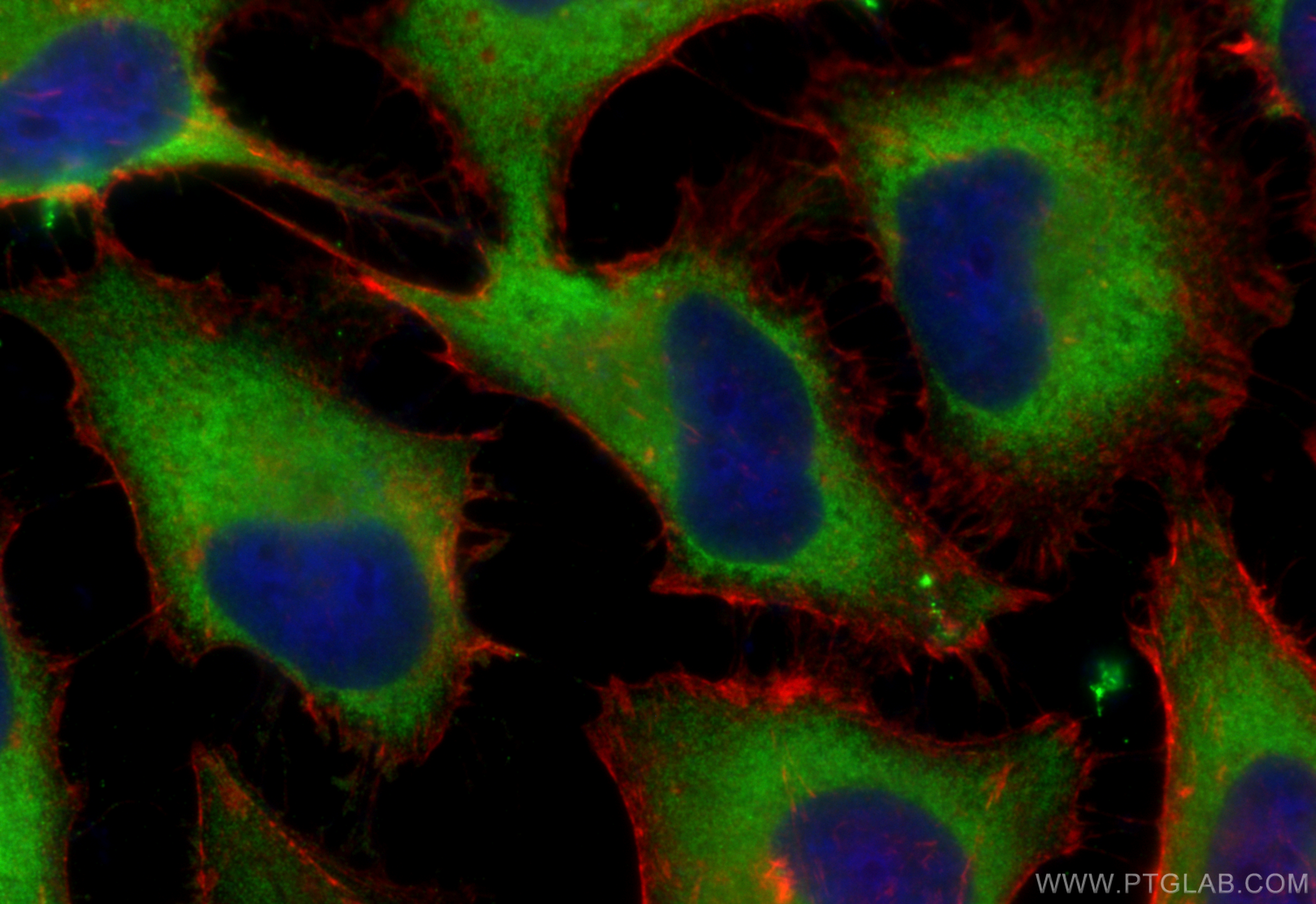 Immunofluorescence (IF) / fluorescent staining of HeLa cells using VTA1 Polyclonal antibody (15786-1-AP)