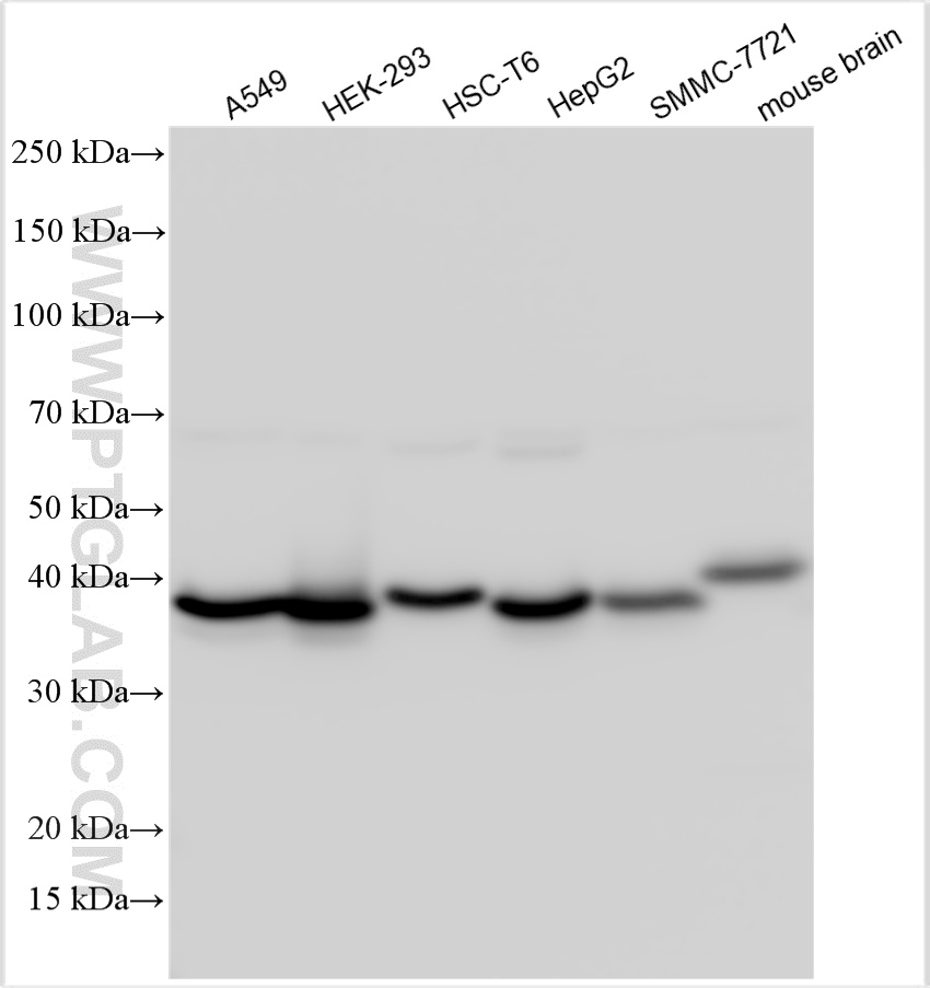 Western Blot (WB) analysis of various lysates using VTA1 Polyclonal antibody (15786-1-AP)