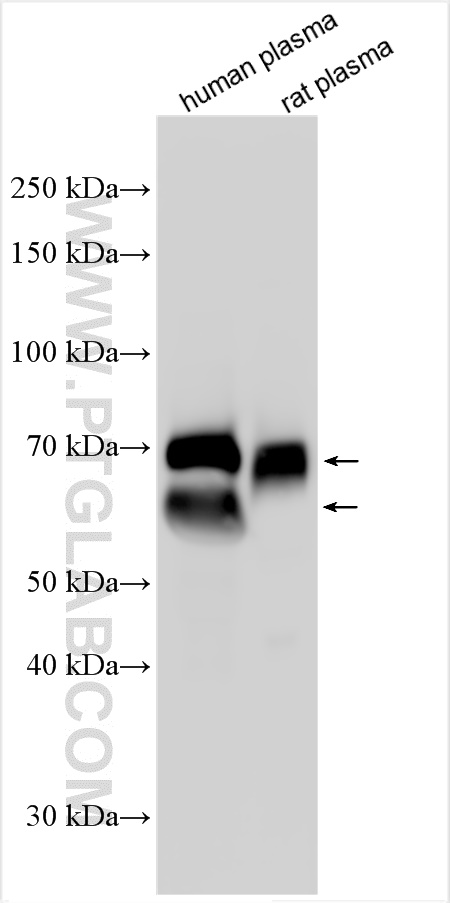 Western Blot (WB) analysis of various lysates using Vitronectin Polyclonal antibody (15833-1-AP)