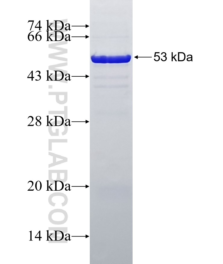 VWA1 fusion protein Ag5717 SDS-PAGE