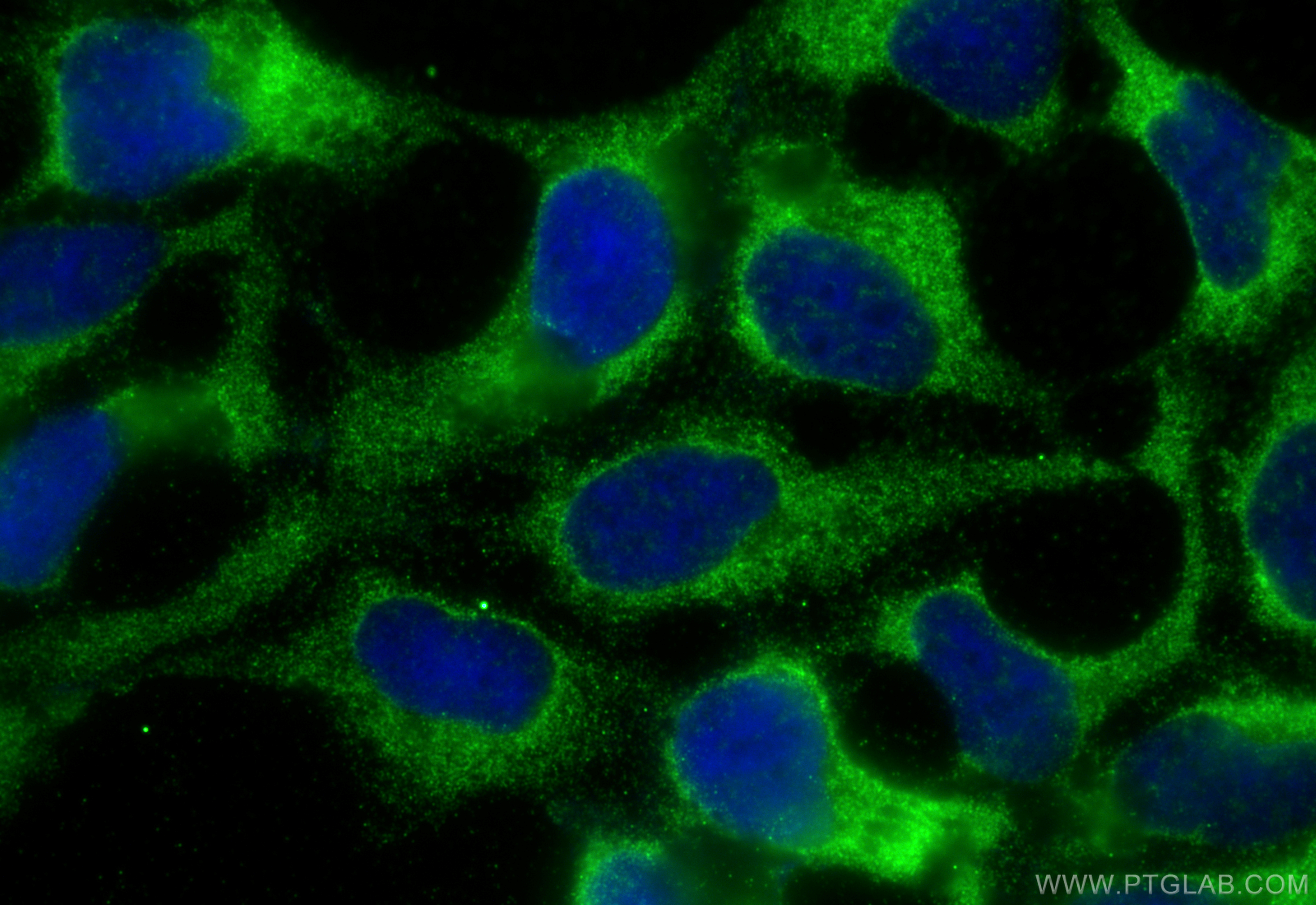 Immunofluorescence (IF) / fluorescent staining of HEK-293 cells using VWA2 Polyclonal antibody (18714-1-AP)