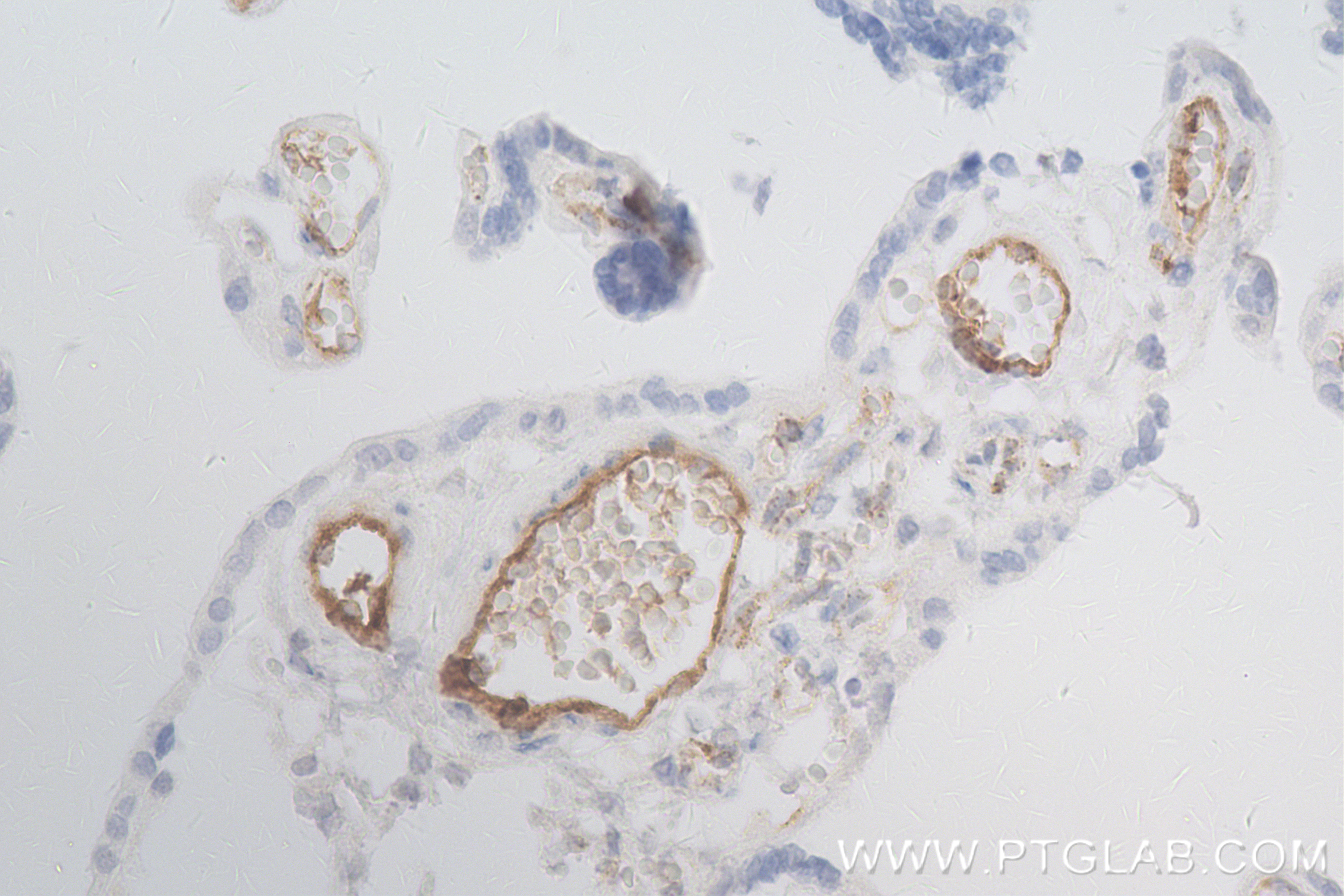 Immunohistochemistry (IHC) staining of human placenta tissue using VWF Recombinant antibody (83854-2-RR)