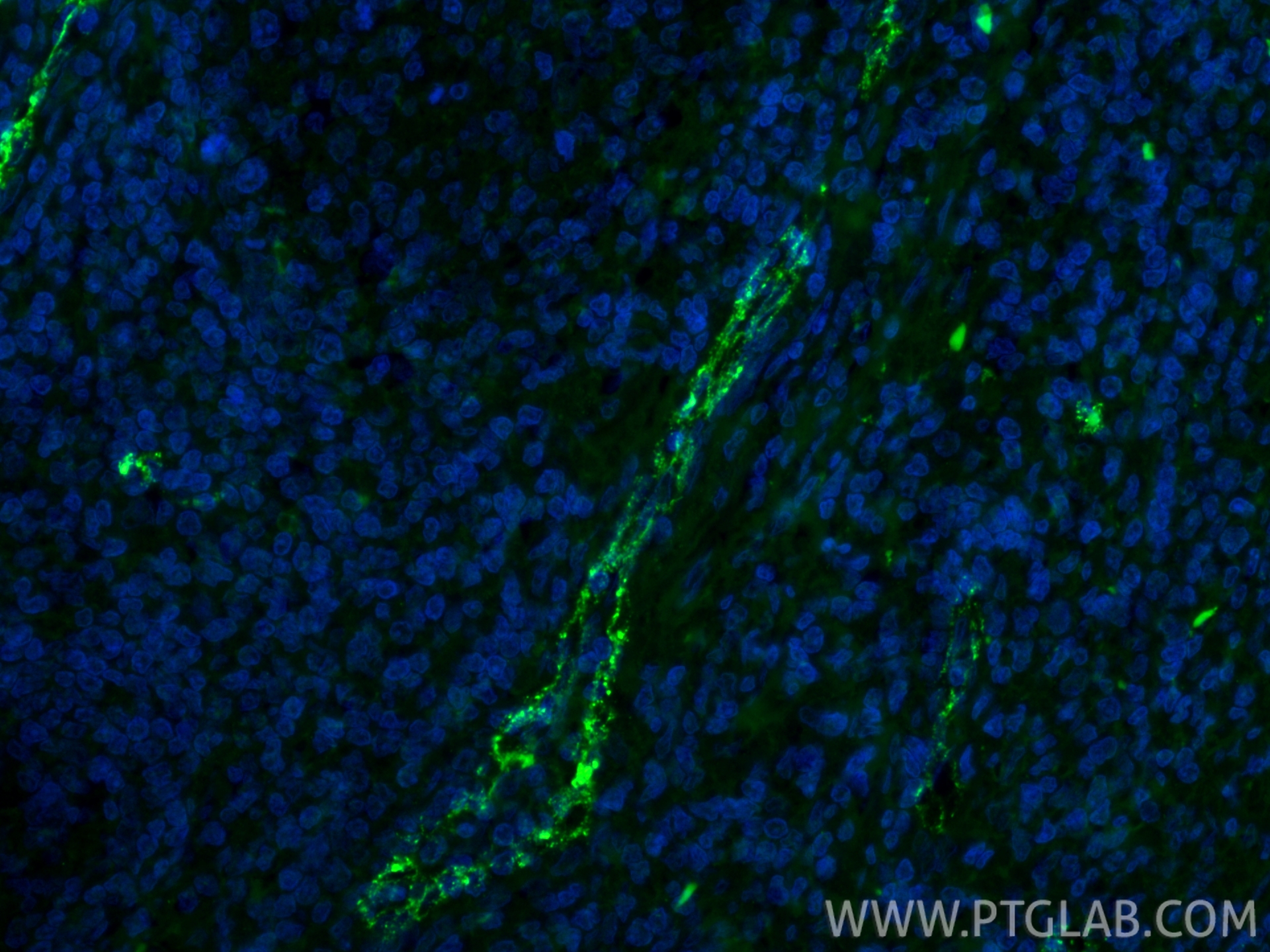 Immunofluorescence (IF) / fluorescent staining of human tonsillitis tissue using CoraLite® Plus 488-conjugated VWF Recombinant mono (CL488-83854-2)