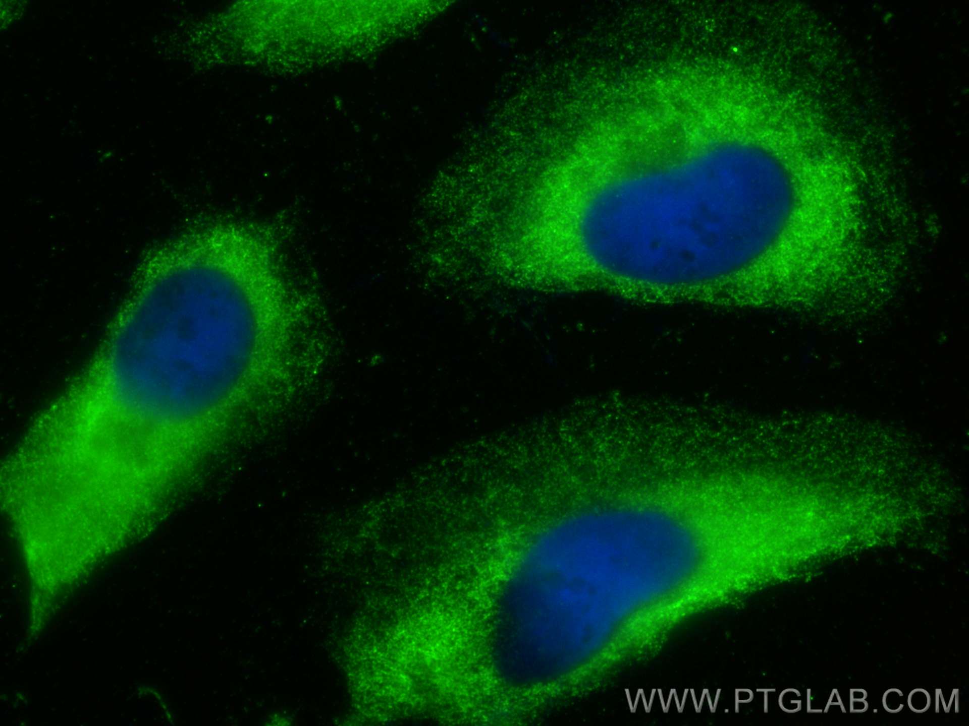 Immunofluorescence (IF) / fluorescent staining of HeLa cells using Vaspin Monoclonal antibody (67573-1-Ig)