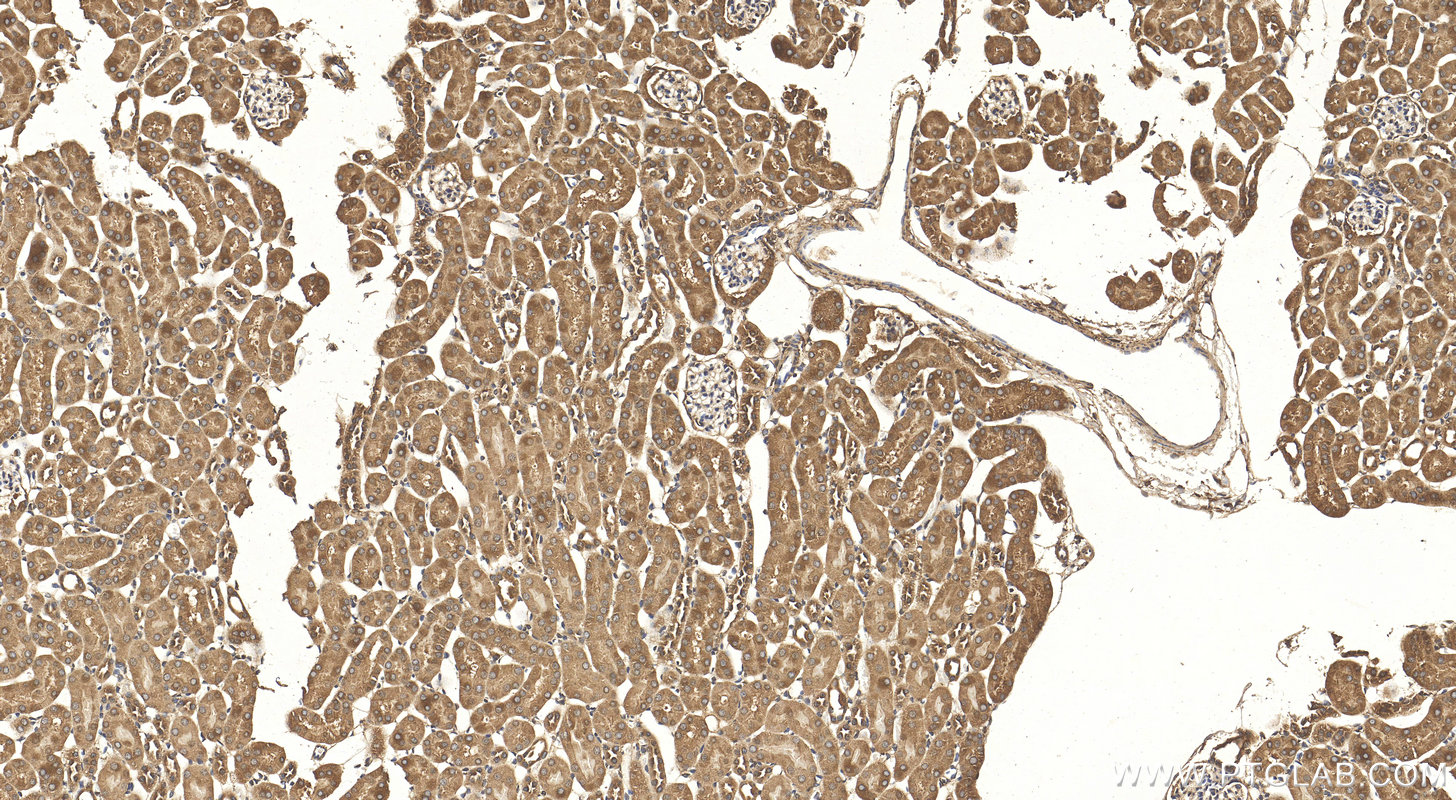 Immunohistochemistry (IHC) staining of mouse kidney tissue using VEGFA Polyclonal antibody (26157-1-AP)