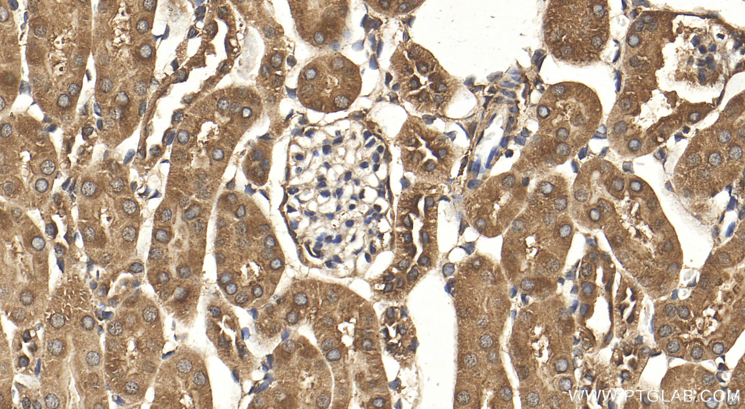 Immunohistochemistry (IHC) staining of mouse kidney tissue using VEGFA Polyclonal antibody (26157-1-AP)