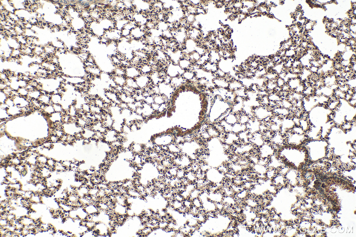Immunohistochemistry (IHC) staining of mouse lung tissue using VEGFA Polyclonal antibody (26157-1-AP)