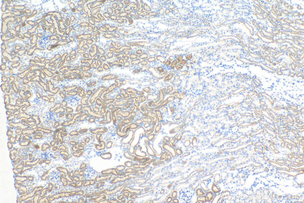 Immunohistochemistry (IHC) staining of mouse kidney tissue using VEGFA Recombinant antibody (82864-7-RR)
