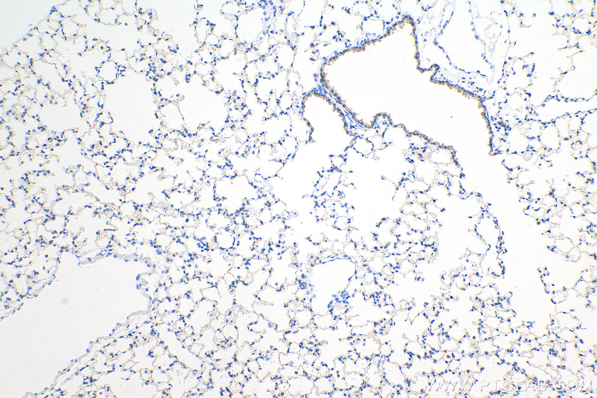 Immunohistochemistry (IHC) staining of mouse lung tissue using VEGFA Recombinant antibody (82864-7-RR)
