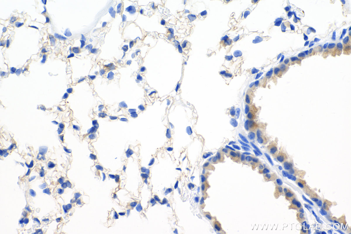 Immunohistochemistry (IHC) staining of mouse lung tissue using VEGFA Recombinant antibody (82864-7-RR)