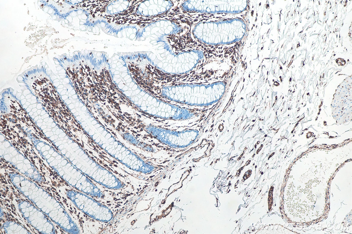 Immunohistochemistry (IHC) staining of human colon tissue using Vimentin Monoclonal antibody (60330-1-Ig)