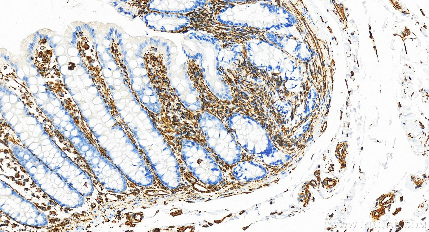 Immunohistochemistry (IHC) staining of human colon tissue using Vimentin Recombinant antibody (80232-1-RR)